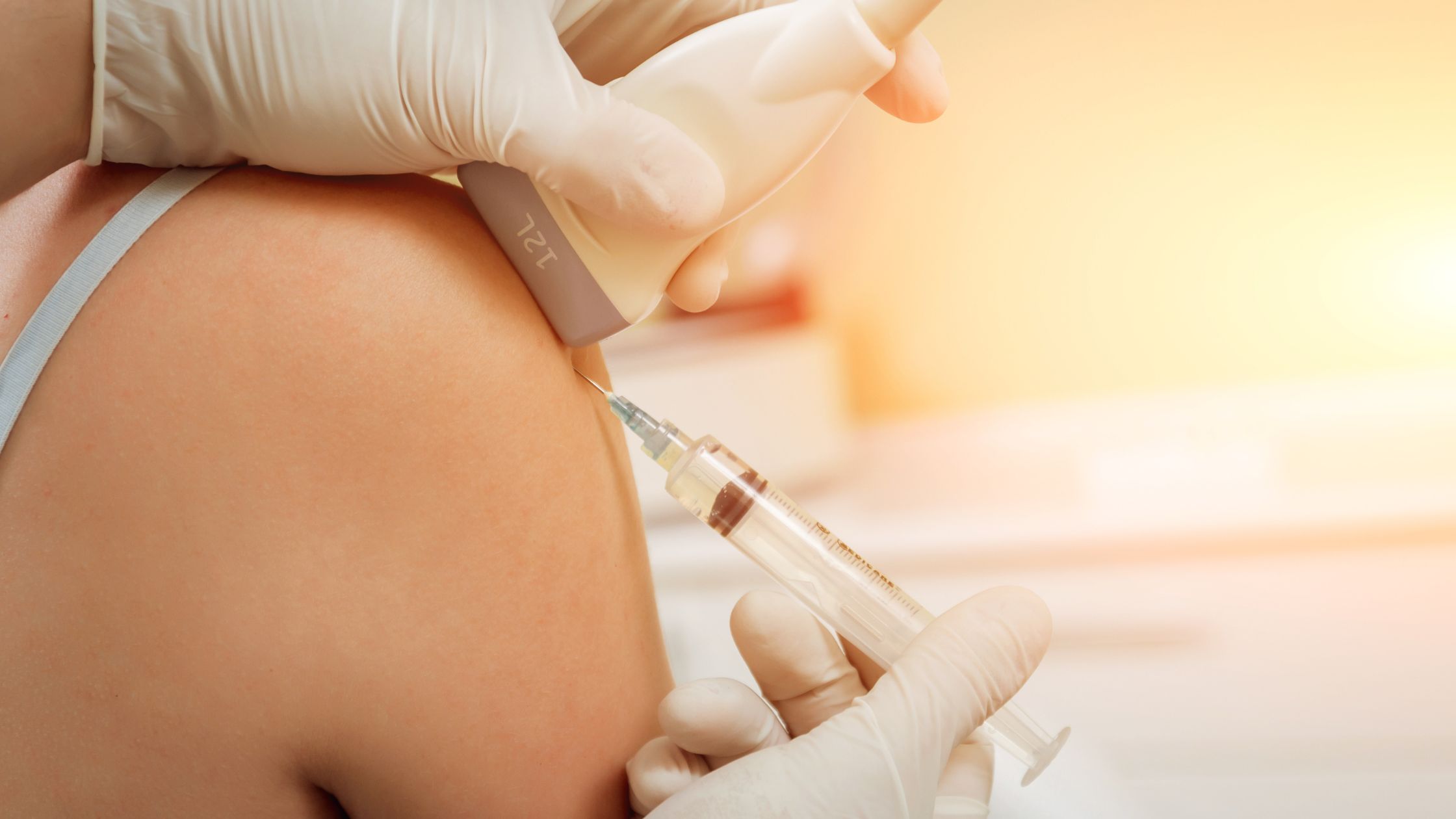 PRP for Shoulder Arthritis and Rotator Cuff Tears: A Natural Option for Pain Relief